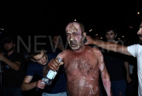 Armenian man who tried to torch himself in Yerevan still very critical
